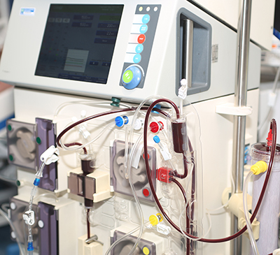 Hemodialysis Equipment Market by End-user and Geography - Forecast and Analysis 2021-2025